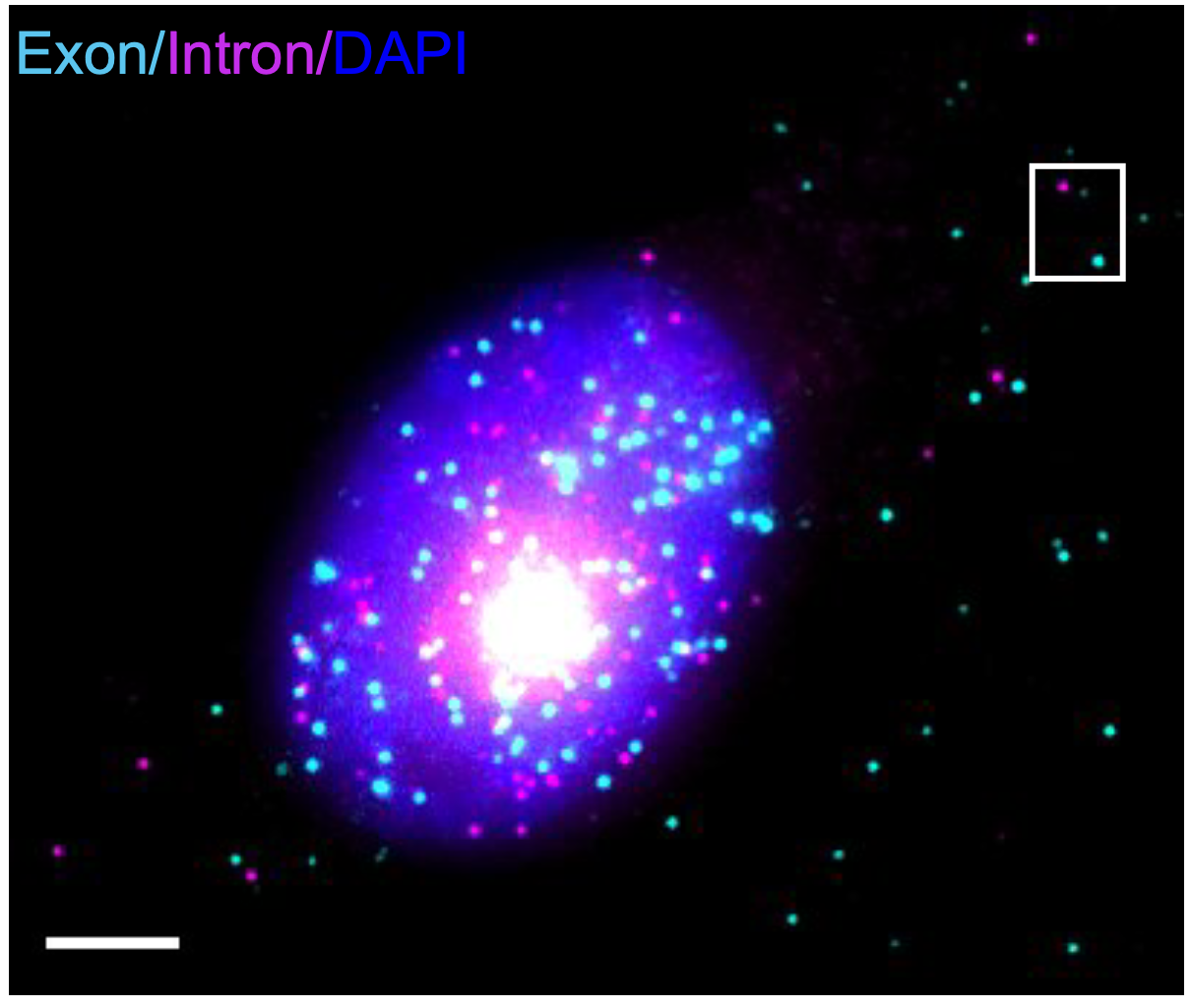 RNA metabolism dysfunction in neurodegeneration Featured Image